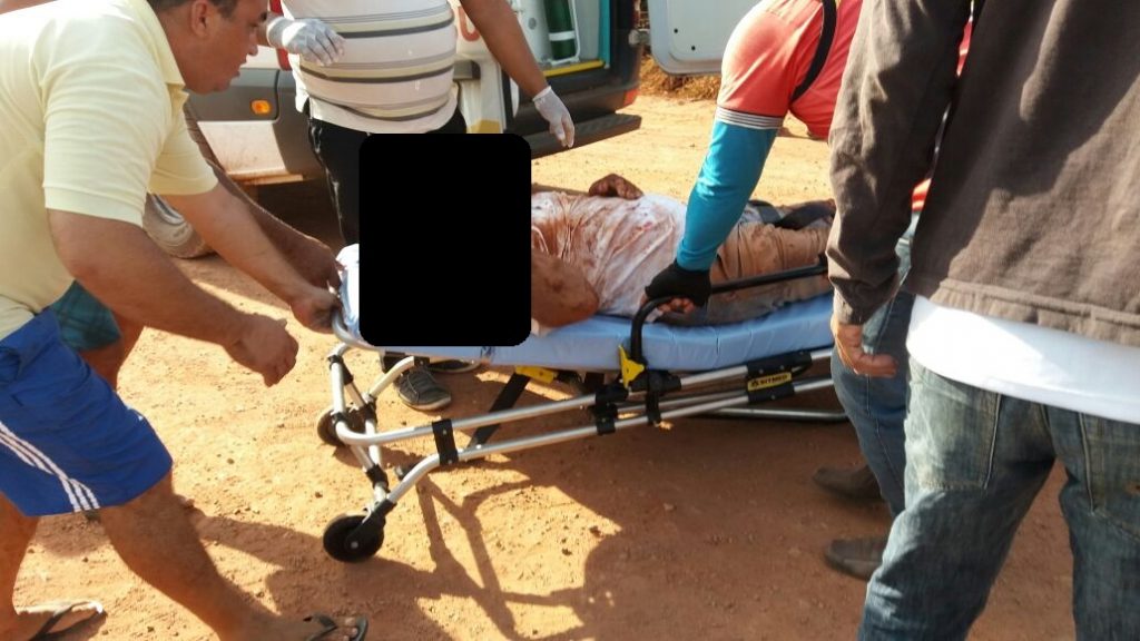 Urgente: grave acidente de moto em Matinha, vejam as fotos