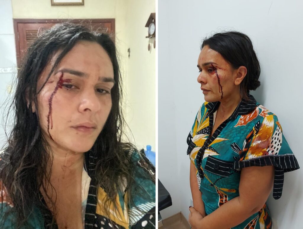 Ex-candidato a prefeito de Matinha é acusado de agredir ex-esposa e atropelar outras duas pessoas em Viana