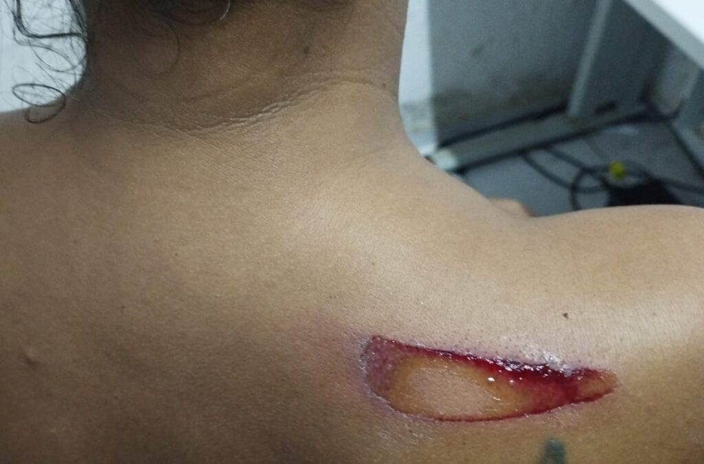 Em Arari, homem é preso após beber e agredir a própria esposa com um facão