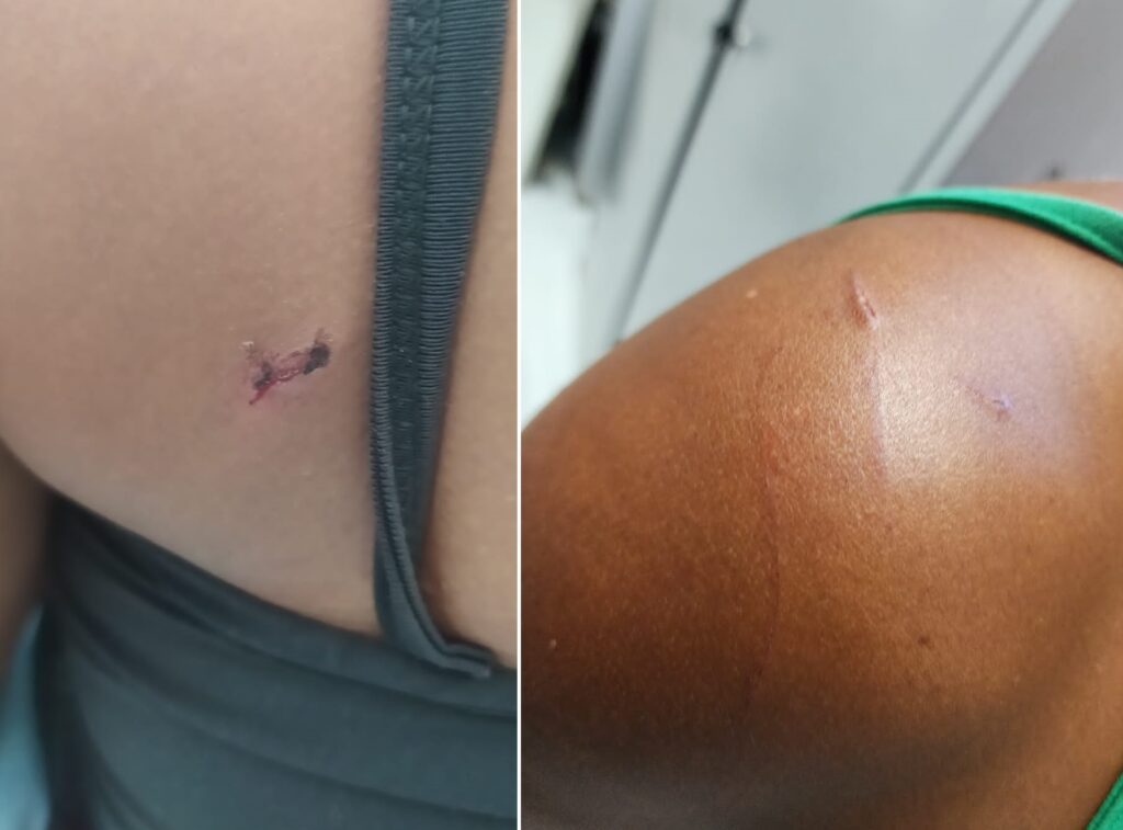 Em Olinda Nova do Maranhão, homem agride esposa, sogra e cunhada e fere dois policiais durante ocorrência