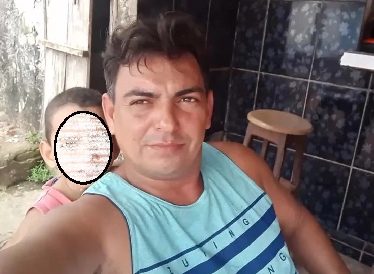 Homem que teve olho perfurado por taco de bilhar durante briga na zona rural de Viana morre em hospital de São Luis